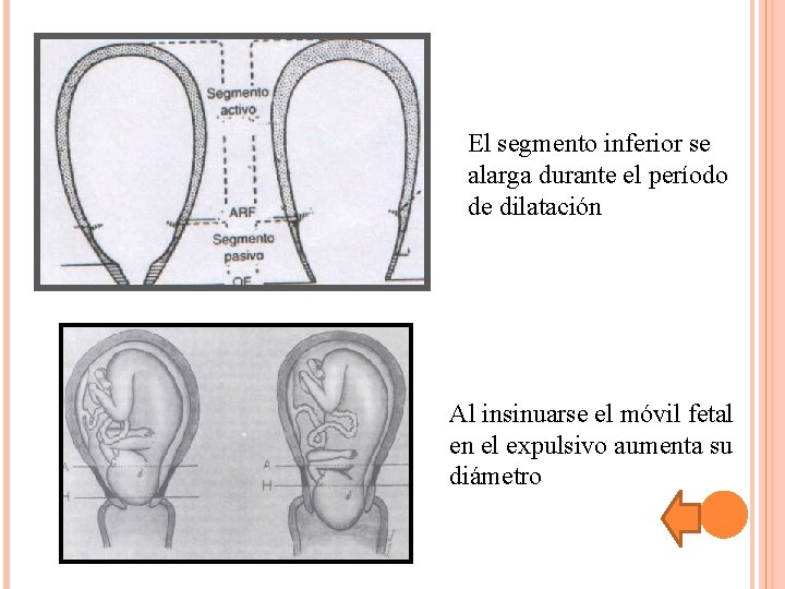 El segmento inferior se alarga durante el período de dilatación Al insinuarse el móvil