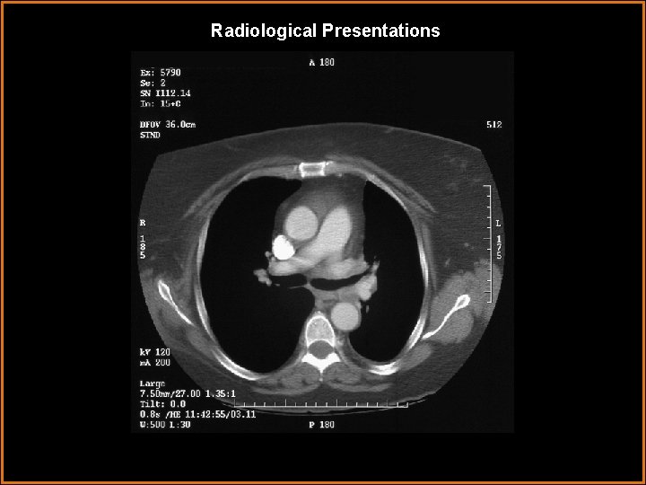 Radiological Presentations 