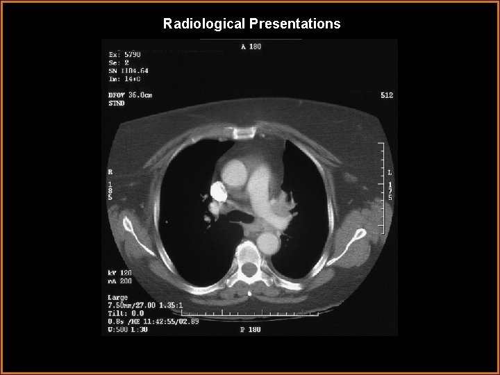 Radiological Presentations 