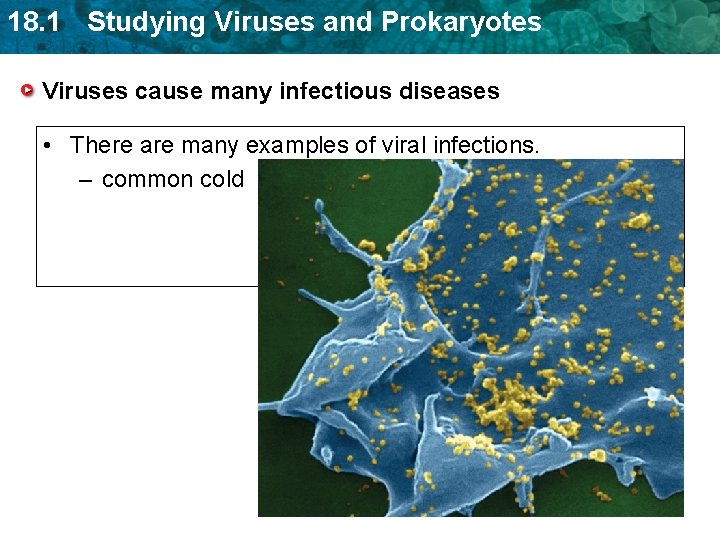 18. 1 Studying Viruses and Prokaryotes Viruses cause many infectious diseases • There are 18. 1 Studying Viruses and Prokaryotes Viruses cause many infectious diseases • There are