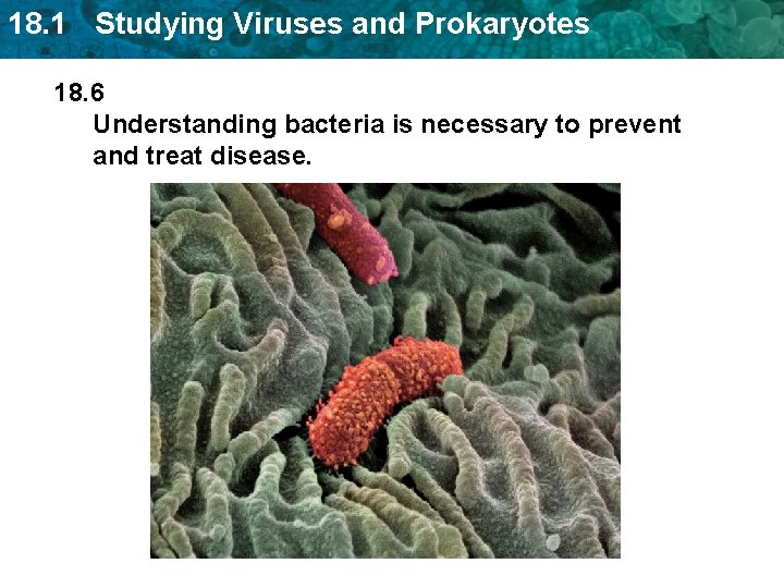 18. 1 Studying Viruses and Prokaryotes 18. 6 Understanding bacteria is necessary to prevent 18. 1 Studying Viruses and Prokaryotes 18. 6 Understanding bacteria is necessary to prevent