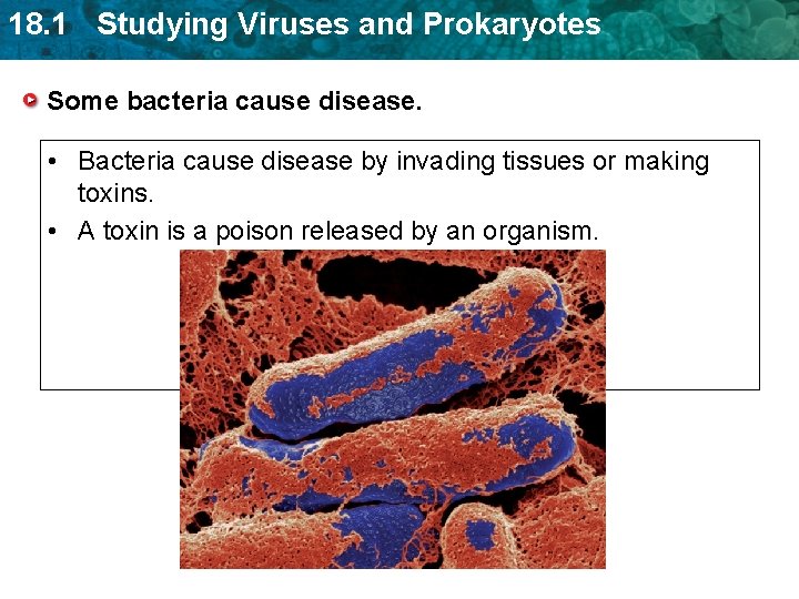 18. 1 Studying Viruses and Prokaryotes Some bacteria cause disease. • Bacteria cause disease 18. 1 Studying Viruses and Prokaryotes Some bacteria cause disease. • Bacteria cause disease