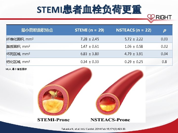 STEMI患者血栓负荷更重 STEMI (n = 29) NSTEACS (n = 22) p 纤维化面积, mm 2 7.