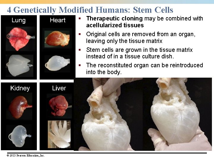 4 Genetically Modified Humans: Stem Cells § Therapeutic cloning may be combined with acellularized