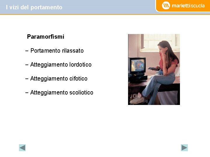 I vizi del portamento Paramorfismi – Portamento rilassato – Atteggiamento lordotico – Atteggiamento cifotico