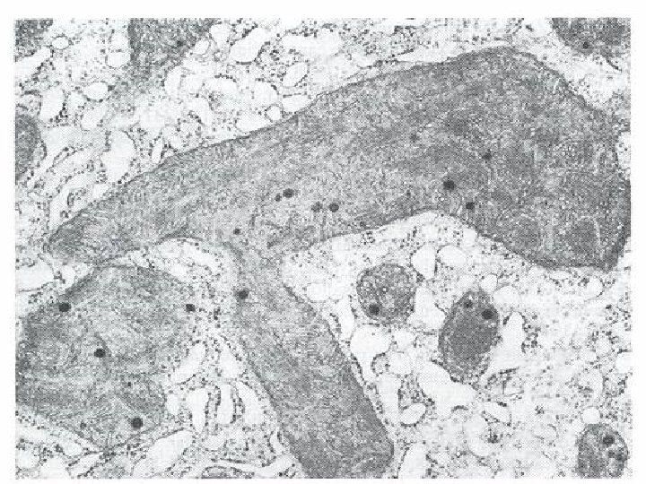 Funky mitochondria 