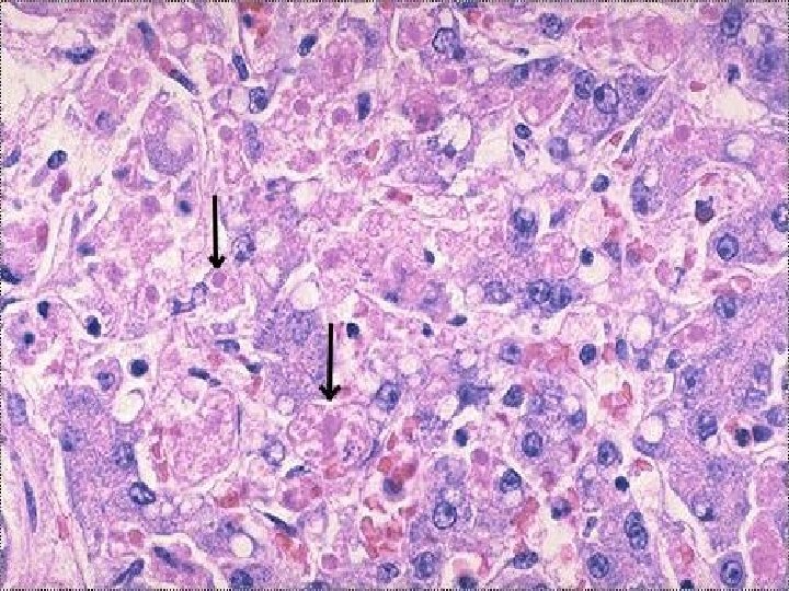 Apoptosis – Micro 