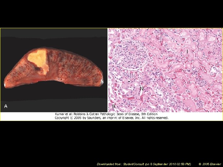 Downloaded from: Student. Consult (on 8 September 2010 02: 58 PM) © 2005 Elsevier