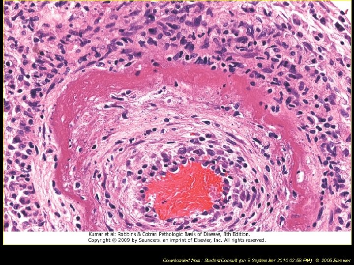 Downloaded from: Student. Consult (on 8 September 2010 02: 58 PM) © 2005 Elsevier