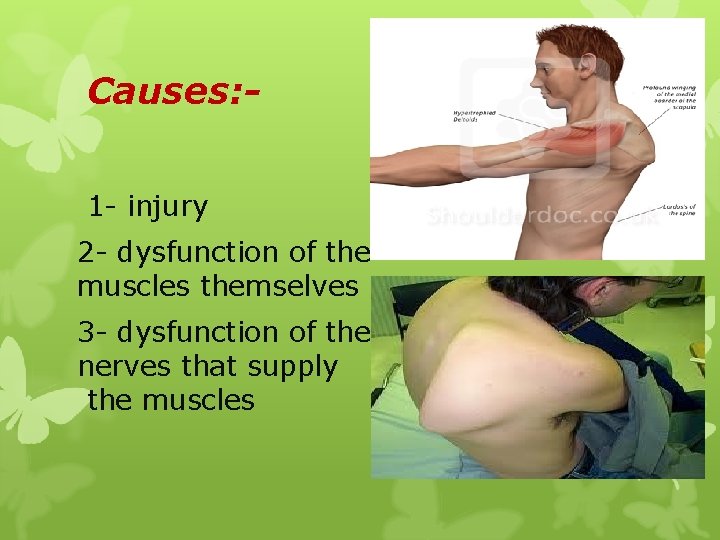 Causes: 1 - injury 2 - dysfunction of the muscles themselves 3 - dysfunction
