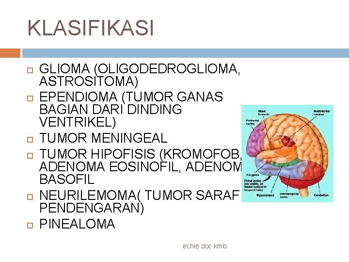 KLASIFIKASI GLIOMA (OLIGODEDROGLIOMA, ASTROSITOMA) EPENDIOMA (TUMOR GANAS BAGIAN DARI DINDING VENTRIKEL) TUMOR MENINGEAL TUMOR