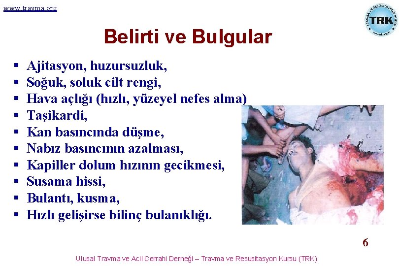 www. travma. org Belirti ve Bulgular § § § § § Ajitasyon, huzursuzluk, Soğuk,