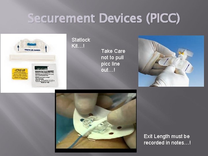 Securement Devices (PICC) Statlock Kit…! Take Care not to pull picc line out…! Exit
