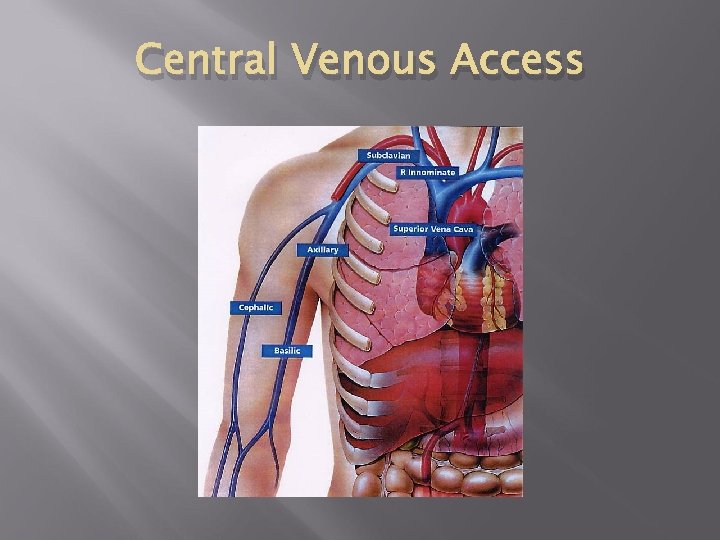 Central Venous Access Central Venous Access