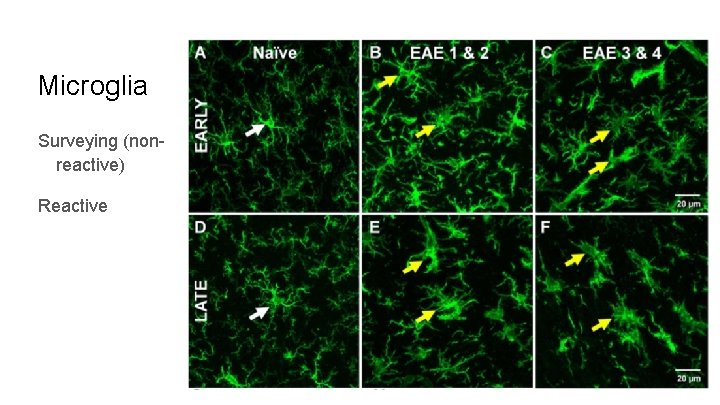 Microglia Surveying (nonreactive) Reactive 