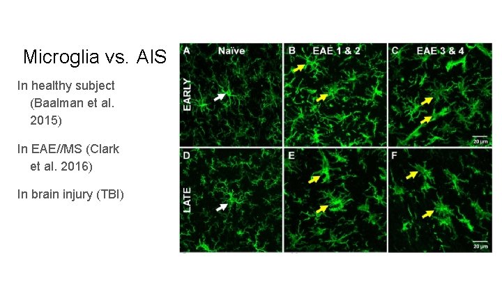 Microglia vs. AIS In healthy subject (Baalman et al. 2015) In EAE//MS (Clark et