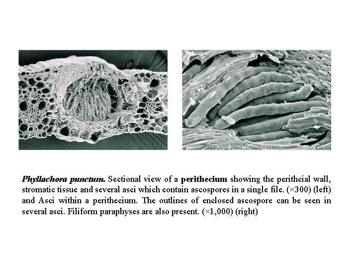 Phyllachora punctum. Sectional view of a perithecium showing the perithcial wall, stromatic tissue and