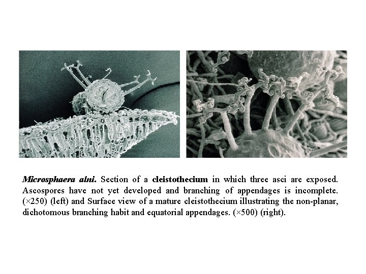 Microsphaera alni. Section of a cleistothecium in which three asci are exposed. Ascospores have