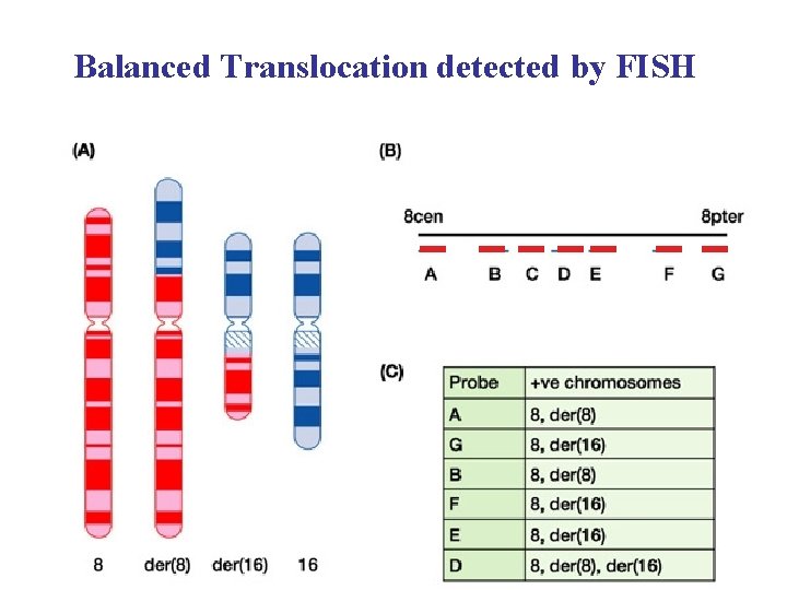Balanced Translocation detected by FISH 1 