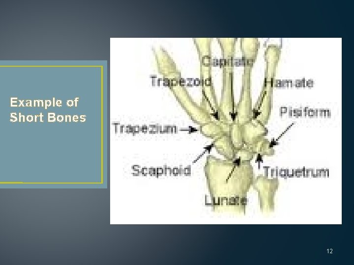 Example of Short Bones 12 
