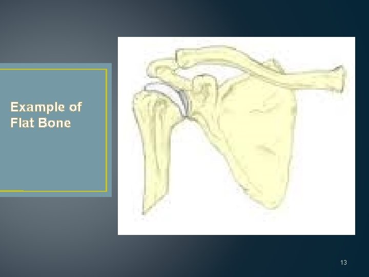 Example of Flat Bone 13 