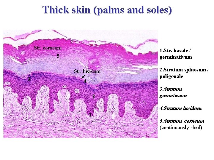 Thick skin (palms and soles) Str. corneum 1. Str. basale / germinativum 5 Str.