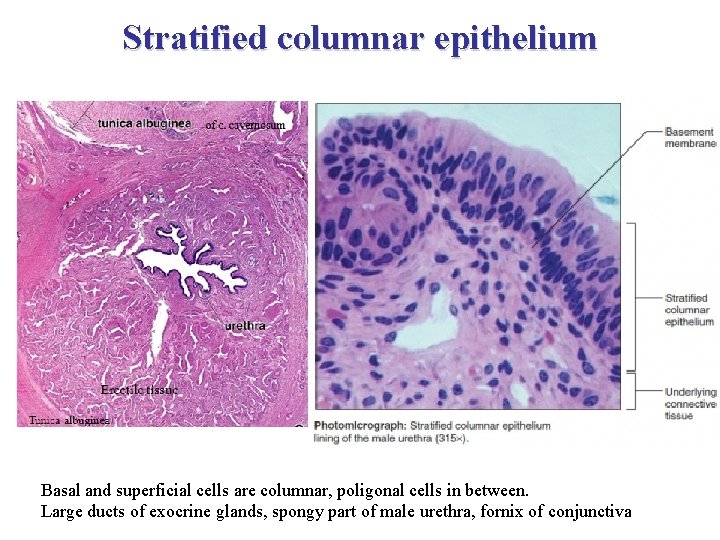 Stratified columnar epithelium Basal and superficial cells are columnar, poligonal cells in between. Large