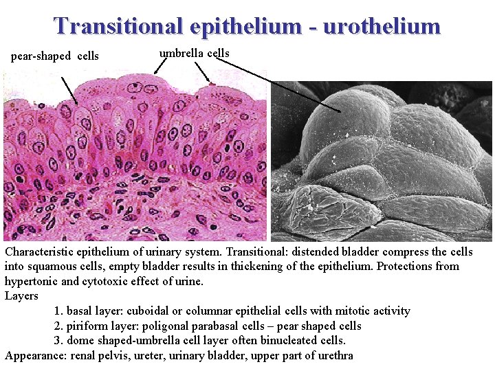 Transitional epithelium - urothelium pear-shaped cells umbrella cells Characteristic epithelium of urinary system. Transitional: