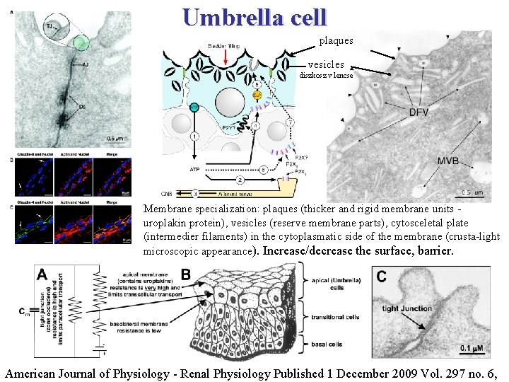 Umbrella cell plaques vesicles diszkosz v lencse Membrane specialization: plaques (thicker and rigid membrane