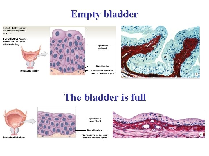 Empty bladder The bladder is full 