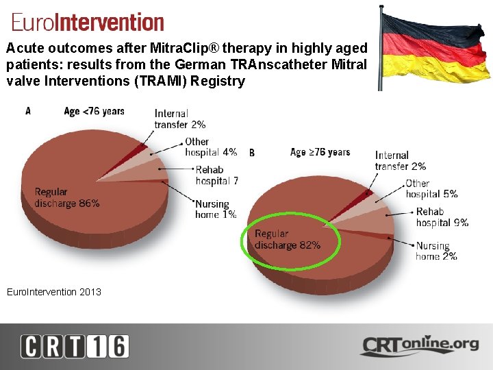 Acute outcomes after Mitra. Clip® therapy in highly aged patients: results from the German