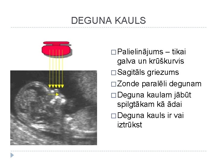 DEGUNA KAULS � Palielinājums – tikai galva un krūškurvis � Sagitāls griezums � Zonde