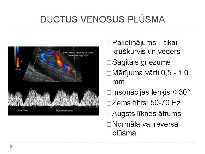 DUCTUS VENOSUS PLŪSMA � Palielinājums – tikai krūškurvis un vēders � Sagitāls griezums �