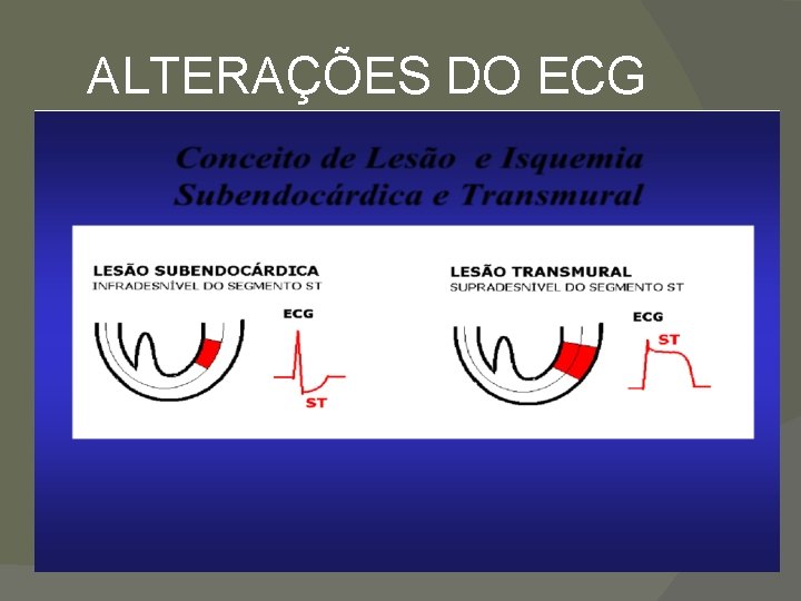 ALTERAÇÕES DO ECG 