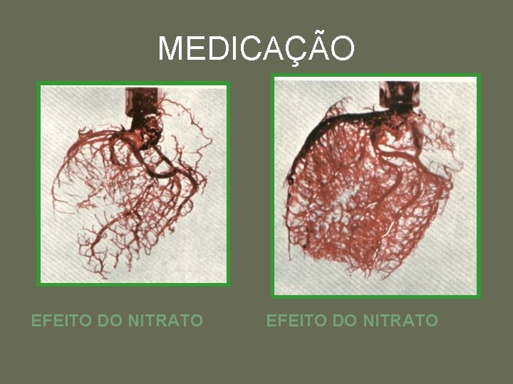 MEDICAÇÃO EFEITO DO NITRATO 