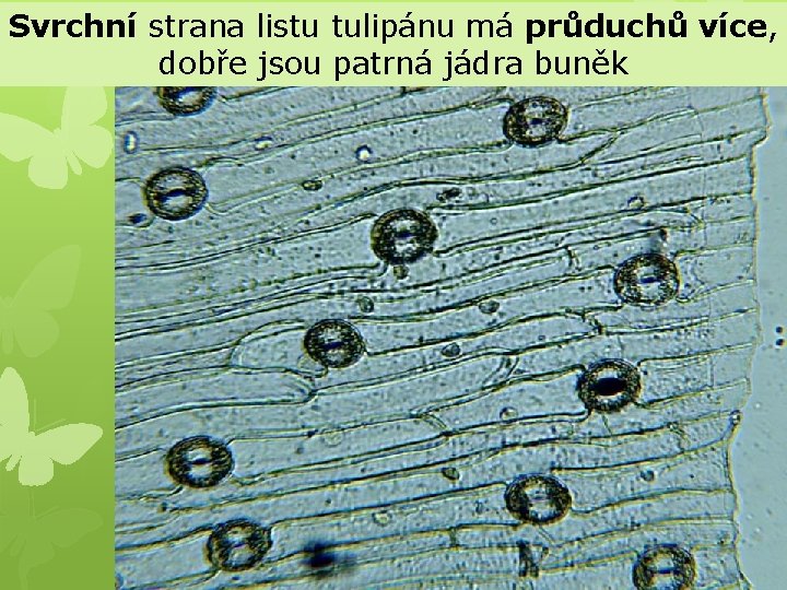 Svrchní strana listu tulipánu má průduchů více, dobře jsou patrná jádra buněk 