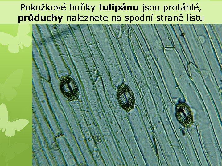 Pokožkové buňky tulipánu jsou protáhlé, průduchy naleznete na spodní straně listu 