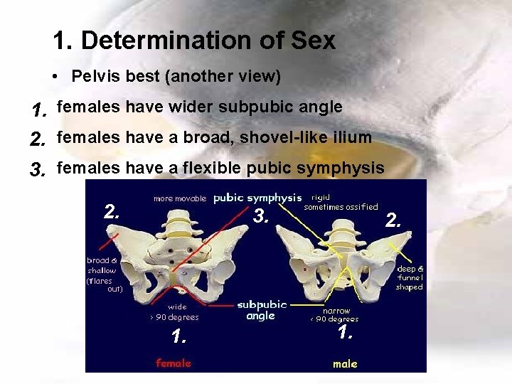 1. Determination of Sex • Pelvis best (another view) 1. females have wider subpubic