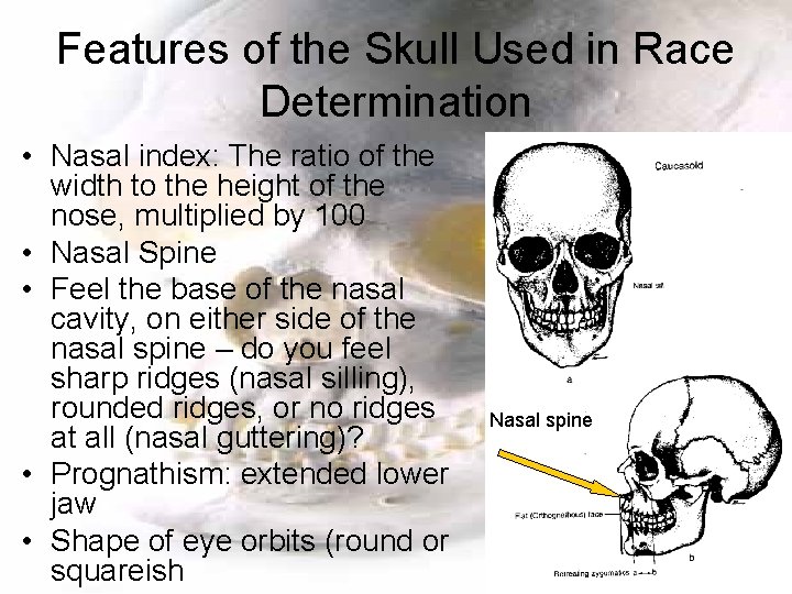 Features of the Skull Used in Race Determination • Nasal index: The ratio of