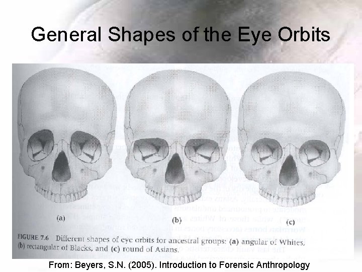 General Shapes of the Eye Orbits From: Beyers, S. N. (2005). Introduction to Forensic