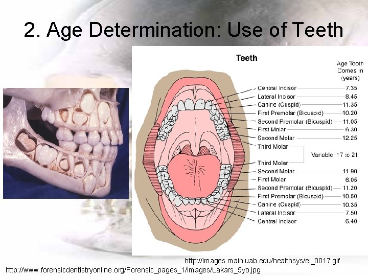 2. Age Determination: Use of Teeth http: //images. main. uab. edu/healthsys/ei_0017. gif http: //www.