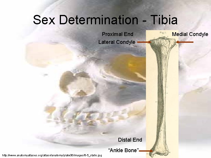 Sex Determination - Tibia Proximal End Lateral Condyle Distal End “Ankle Bone” http: //www.