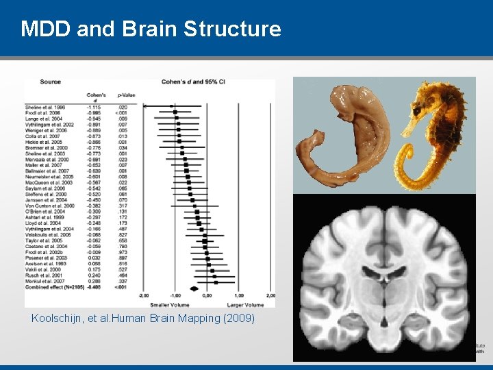 MDD and Brain Structure Koolschijn, et al. Human Brain Mapping (2009) MDD and Brain Structure Koolschijn, et al. Human Brain Mapping (2009)