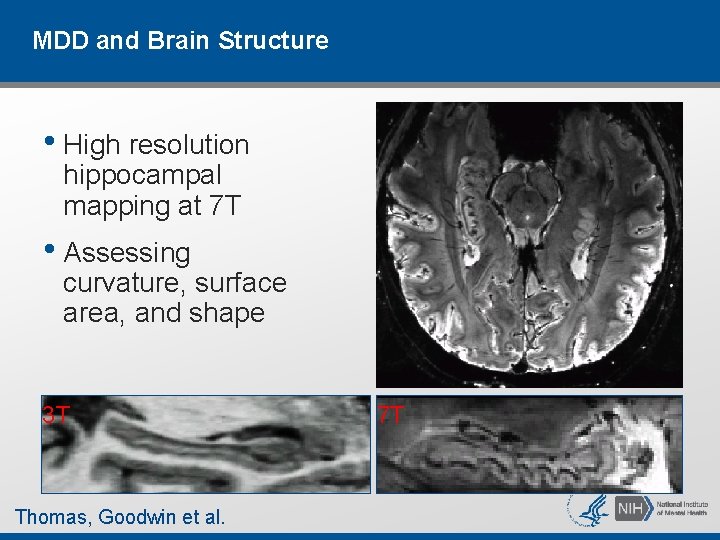 MDD and Brain Structure • High resolution hippocampal mapping at 7 T • Assessing MDD and Brain Structure • High resolution hippocampal mapping at 7 T • Assessing