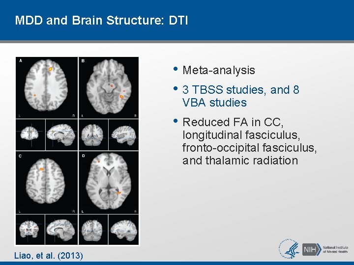 MDD and Brain Structure: DTI • Meta-analysis • 3 TBSS studies, and 8 VBA MDD and Brain Structure: DTI • Meta-analysis • 3 TBSS studies, and 8 VBA