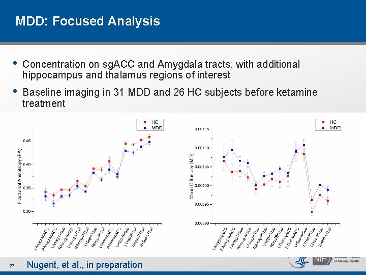MDD: Focused Analysis • Concentration on sg. ACC and Amygdala tracts, with additional hippocampus MDD: Focused Analysis • Concentration on sg. ACC and Amygdala tracts, with additional hippocampus