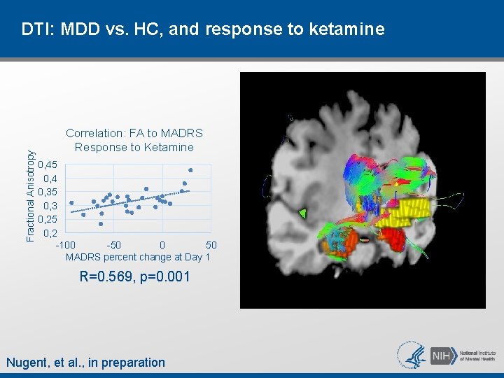 Fractional Anisotropy DTI: MDD vs. HC, and response to ketamine Correlation: FA to MADRS Fractional Anisotropy DTI: MDD vs. HC, and response to ketamine Correlation: FA to MADRS