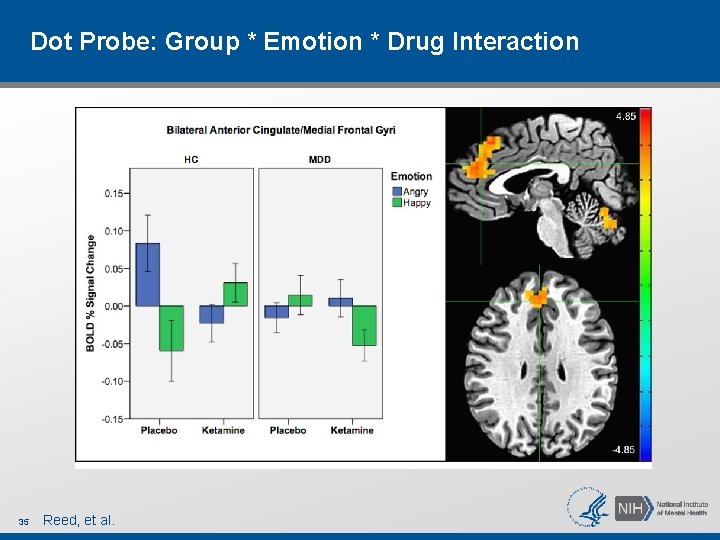 Dot Probe: Group * Emotion * Drug Interaction 35 Reed, et al. Dot Probe: Group * Emotion * Drug Interaction 35 Reed, et al.