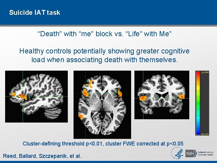 Suicide IAT task “Death” with “me” block vs. “Life” with Me” Healthy controls potentially Suicide IAT task “Death” with “me” block vs. “Life” with Me” Healthy controls potentially