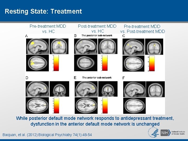 Resting State: Treatment Pre-treatment MDD vs. HC Post-treatment MDD Pre-treatment MDD vs. HC vs. Resting State: Treatment Pre-treatment MDD vs. HC Post-treatment MDD Pre-treatment MDD vs. HC vs.